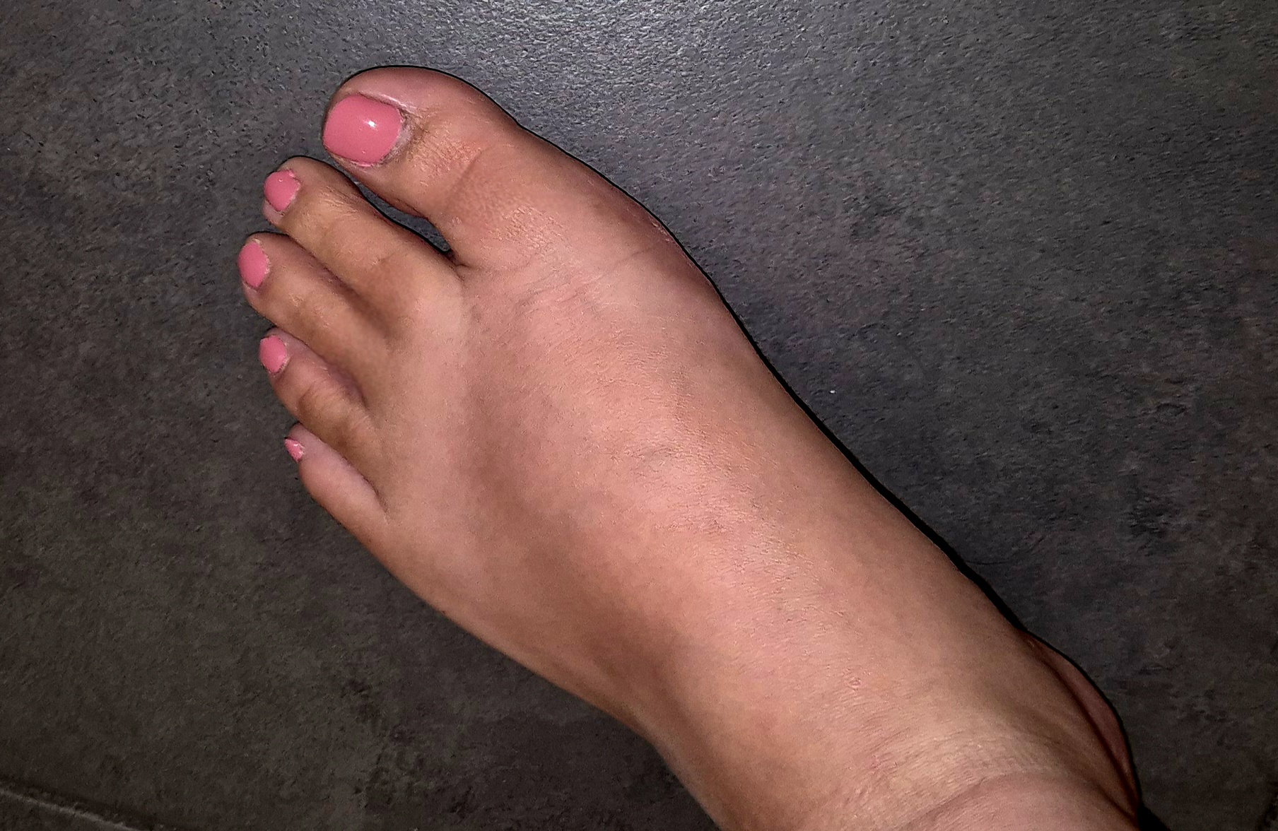 @Mila